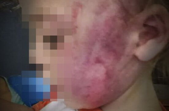 Comissão de Proteção de Crianças e Jovens quer vigiar pais de bebé agredido
