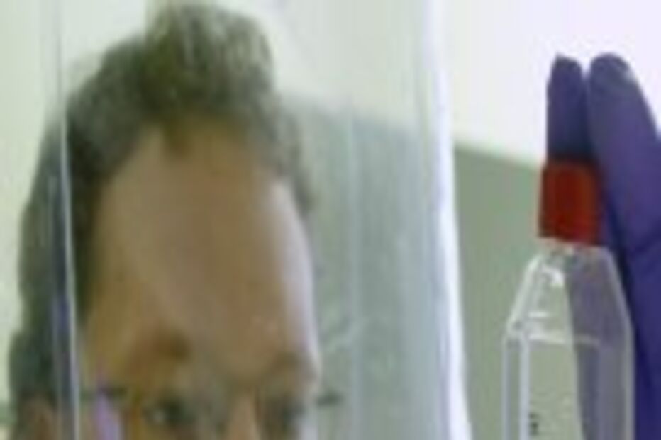 Terapia devolve esperança de cura para Sida