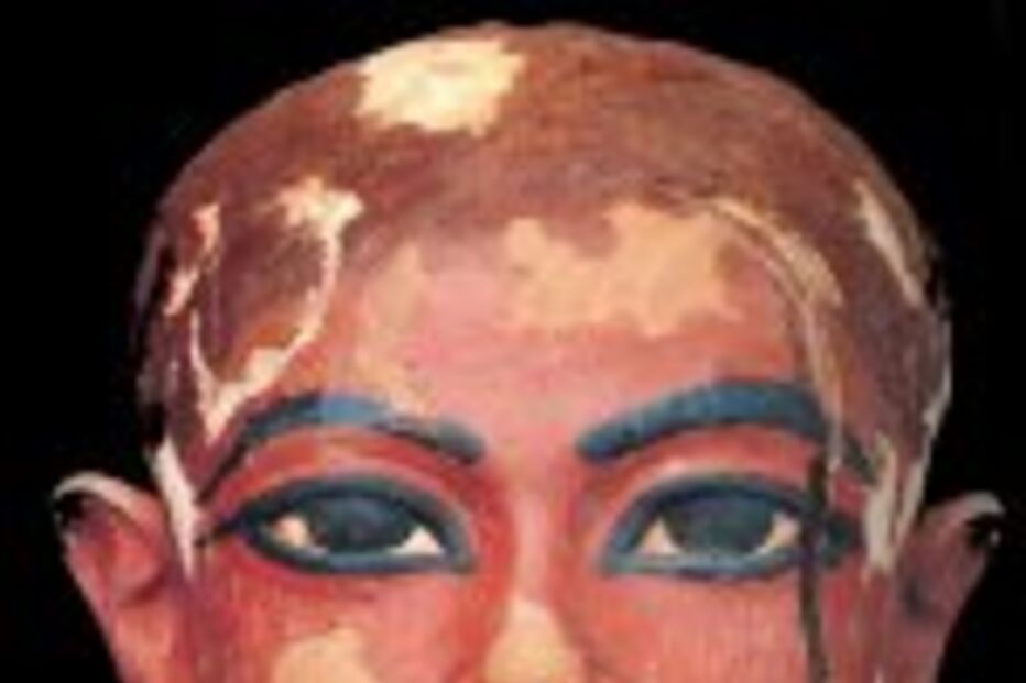 Tutankhamon morreu de gangrena