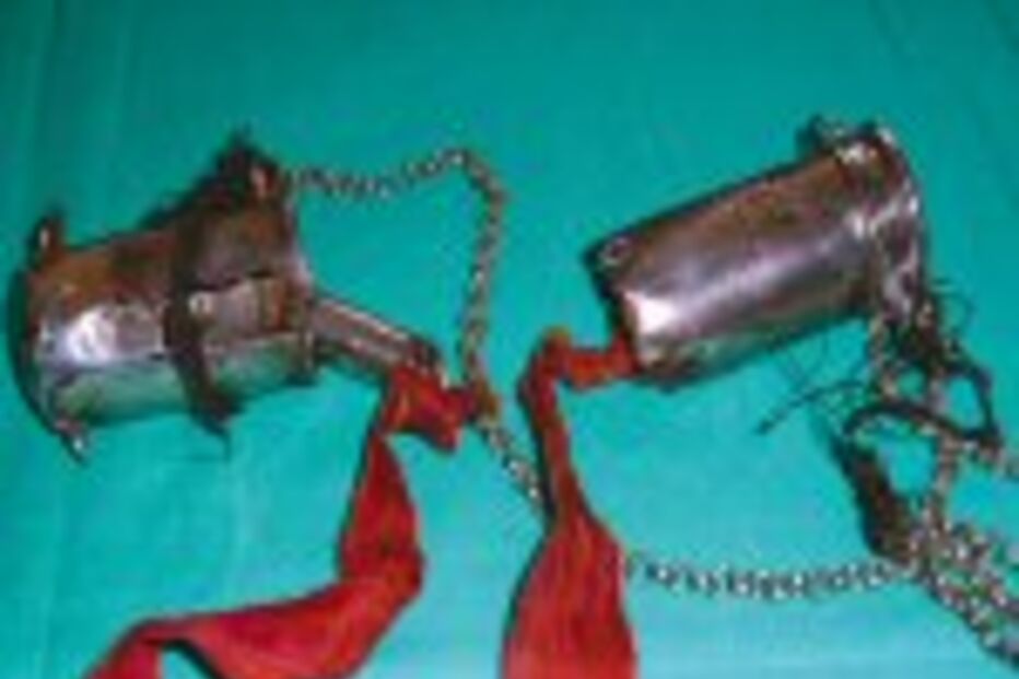 Descoberto dente santo