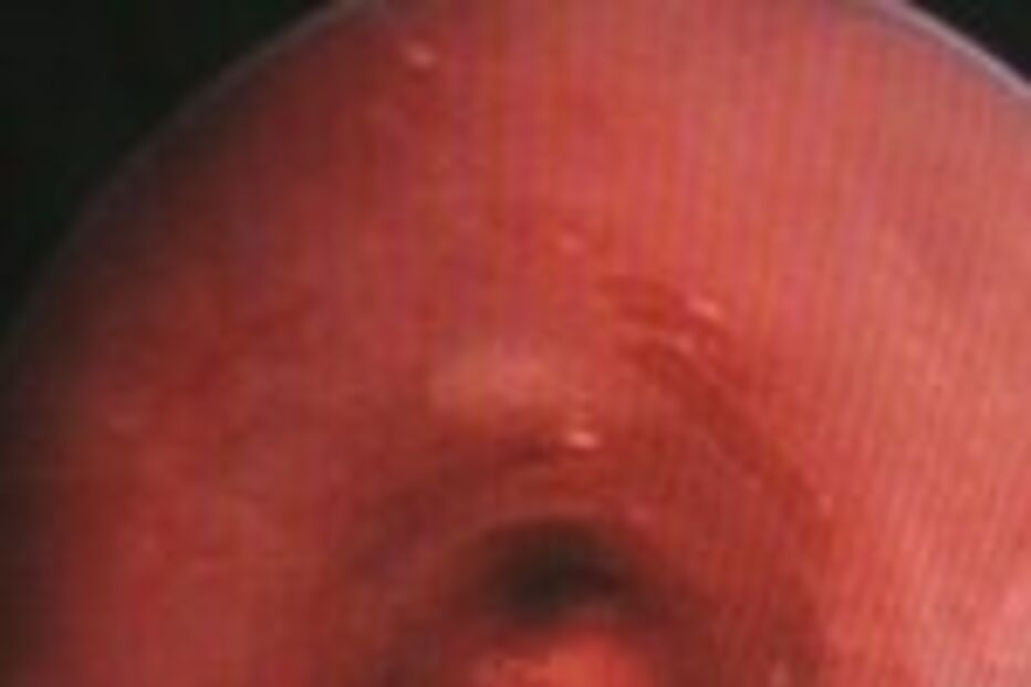 Interior do corpo humano a nu