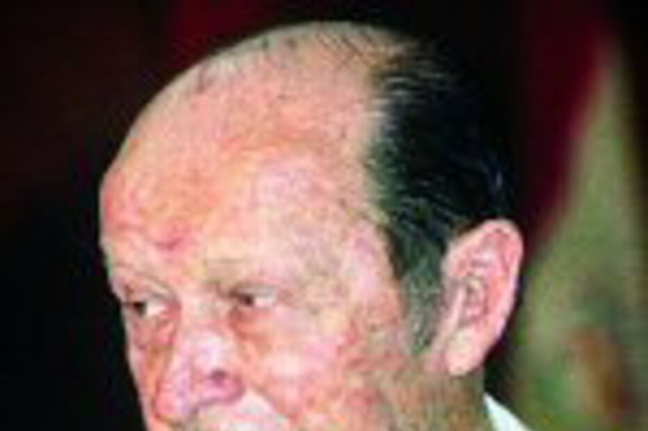 Morreu Alfredo Stroessner