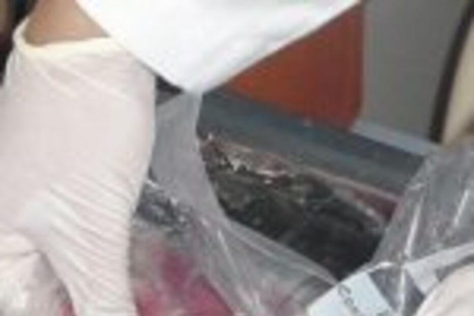 Maioria aceita doar órgãos