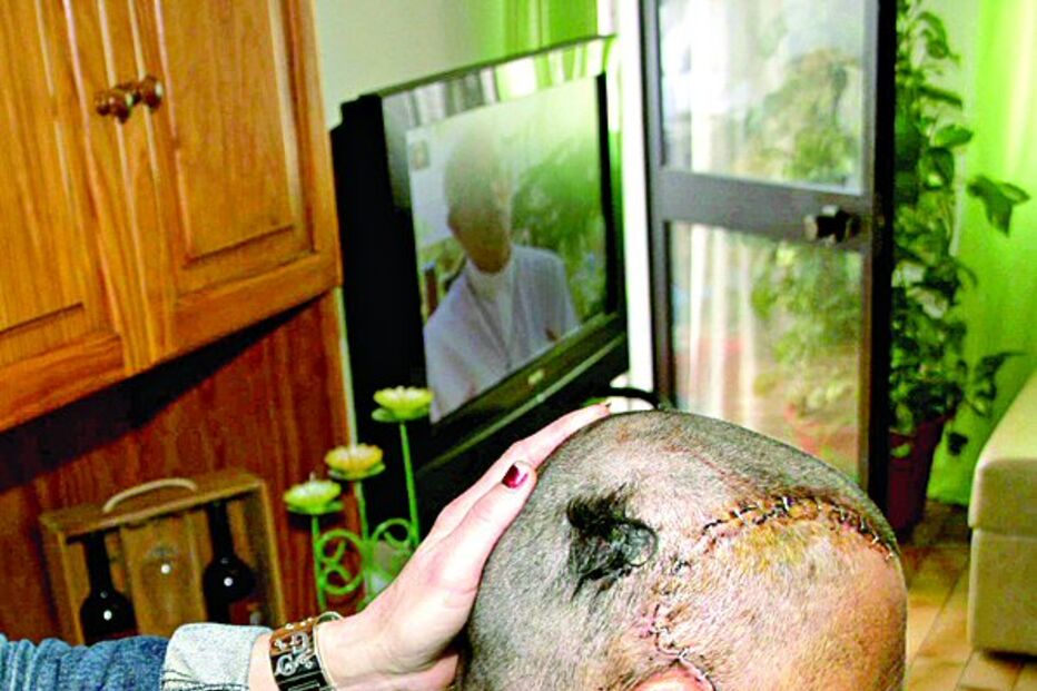 Diagnosticado à terceira vez