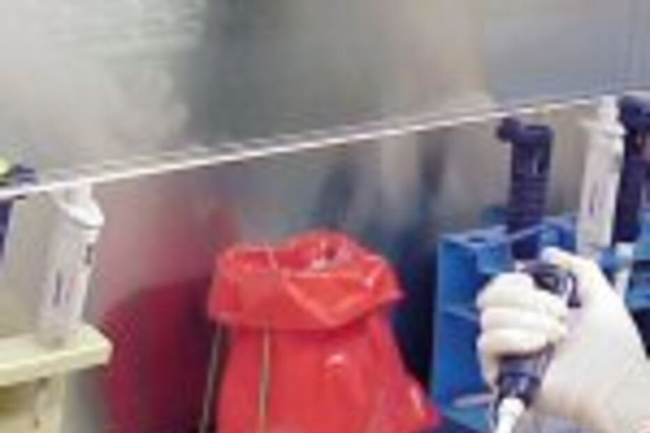 SIDA: Tratamento deve começar mais cedo