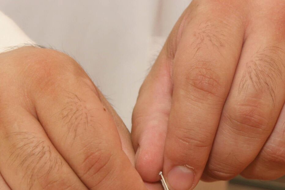 Medicina chinesa deve ser integrada