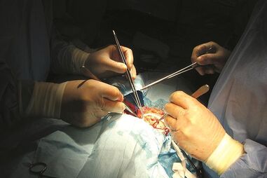 Transplantes hepáticos feitos por um só médico