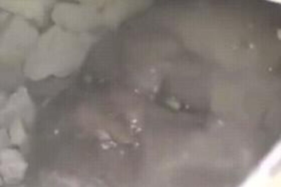 Haiti: Enfermeira soterrada foi salva (COM VÍDEO)