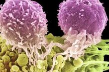 Menopausa cria na mama ambiente favorável ao desenvolvimento de células cancerígenas