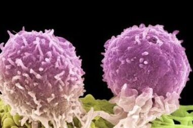 Células cancerígenas