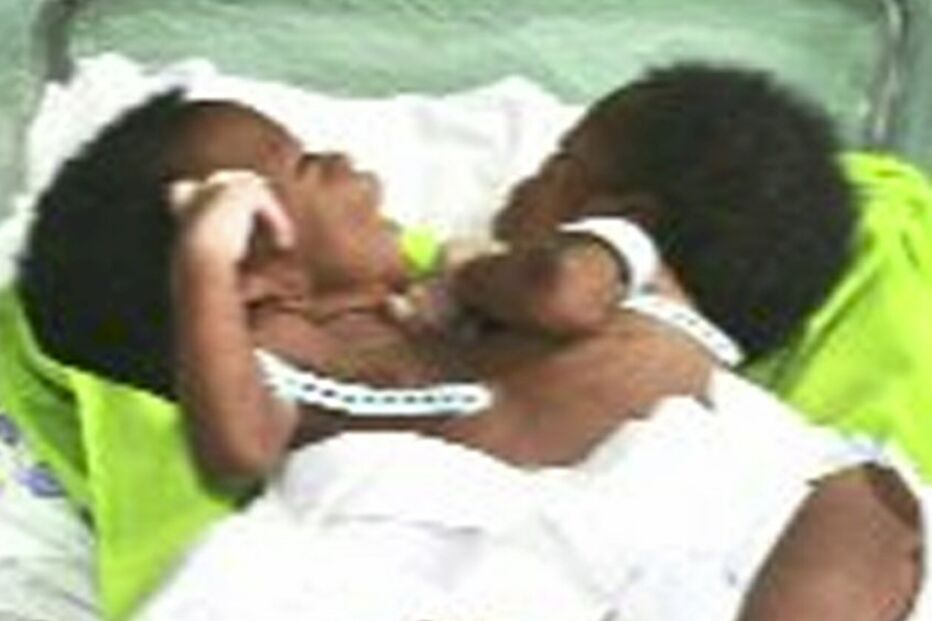 Siameses, Angola, Operação