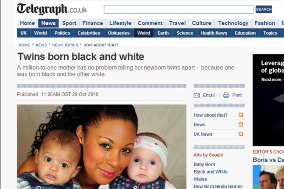 Inglaterra, Gémeos, Branco, Negro