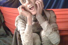 Modelo anoréctica Isabelle Caro morre aos 28 anos