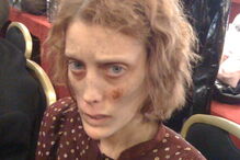 Modelo anoréctica Isabelle Caro morre aos 28 anos