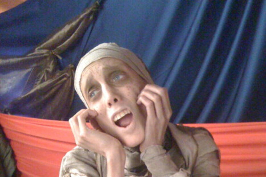 Modelo anoréctica Isabelle Caro morre aos 28 anos