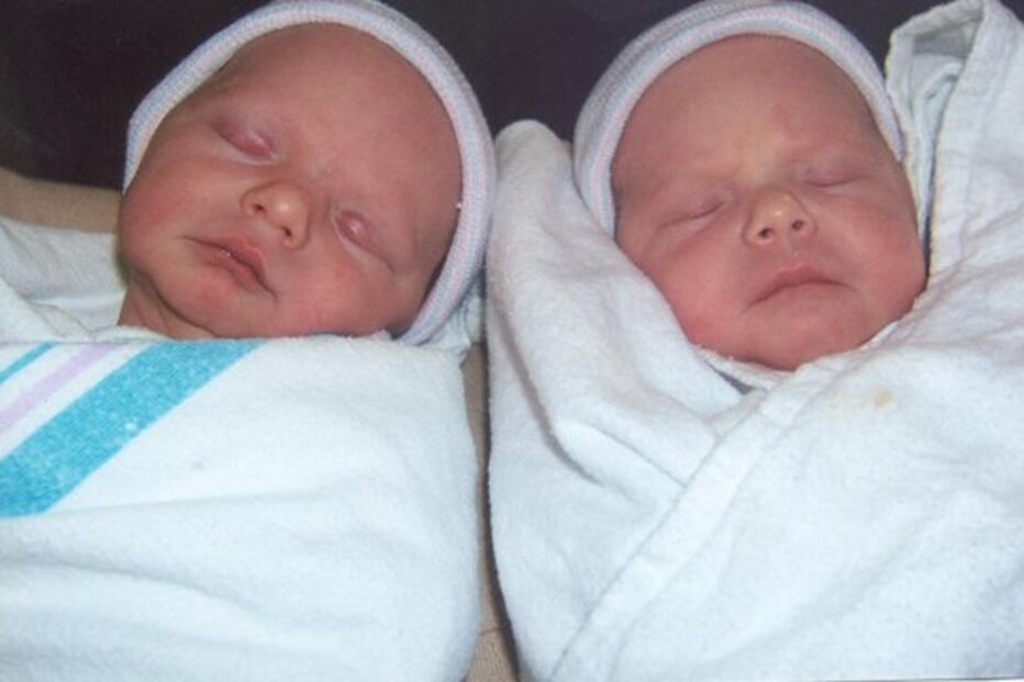 Mulher dá à luz gémeos de pais diferentes
