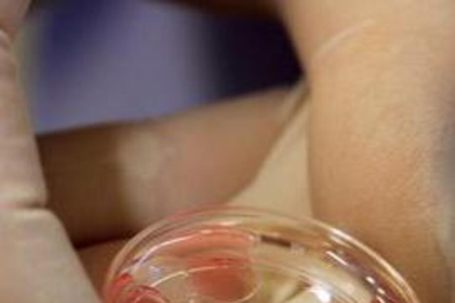 sémen, esperma, infertilidade, ana jorge, maternidade alfredo da costa 