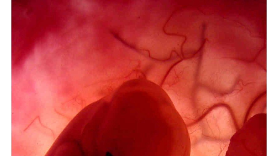 A membrana amniótica é o tecido que reveste a parte interior da placenta. É aplicada no tratamento de queimaduras e de lesões na córnea. Os tratamentos são eficazes e a regeneração revela-se rápida