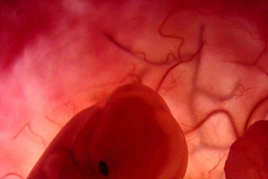 ENXERTOS, PLACENTA, QUEIMADURAS, PELE