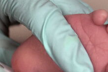 TESTE DO PEZINHO, SAÚDE, INSTITUTO RICARDO JORGE