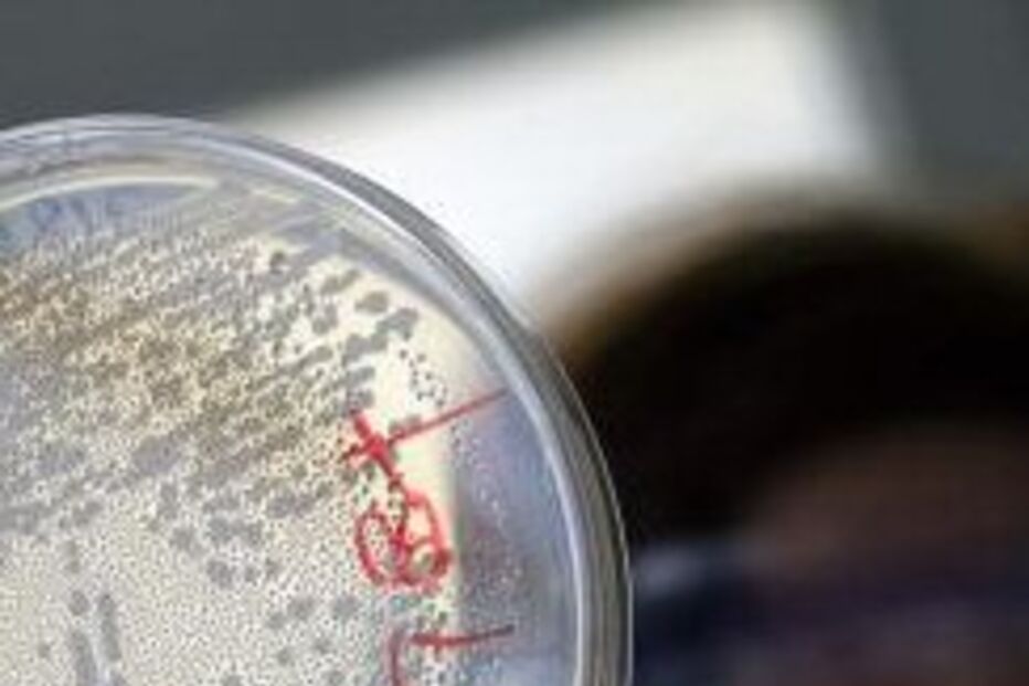 e.coli, bactéria, alemanha, suécia, cientistas