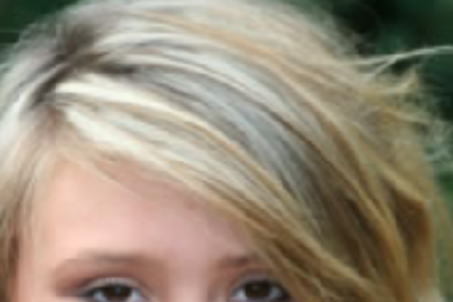 Síndrome Kleine-Levin, Lily Clarke