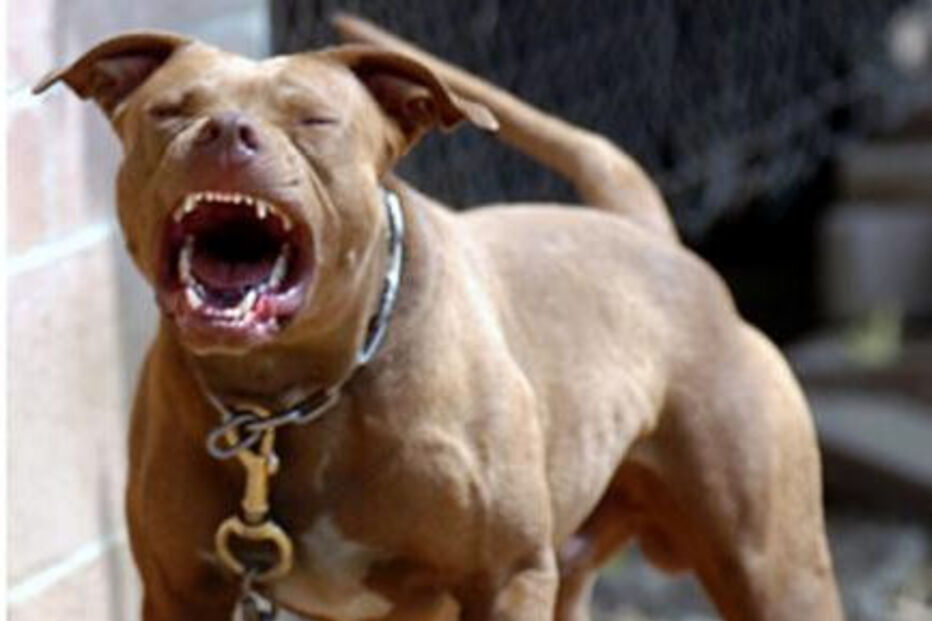 Ataque, Pitbull, Cão, Morte, Polícia, Ferimentos