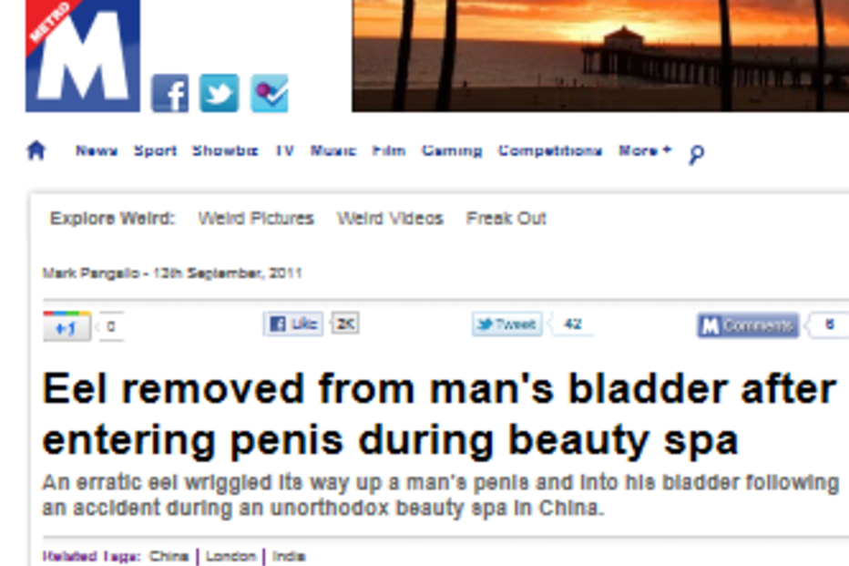 insólito, chinês, enguia, cirurgia, china, spa