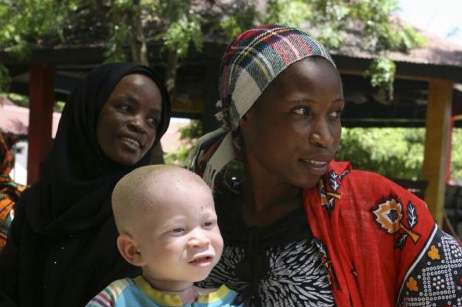 albinismo, tratamento, melanina, ratos, pigmentação