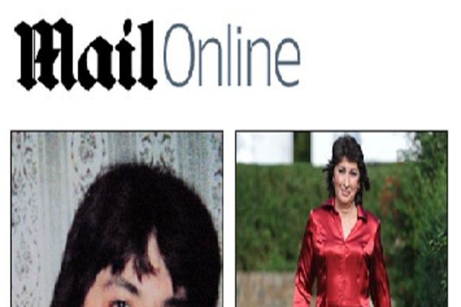 Amputação, Kirsty Cass,West Sussex, Inglaterra