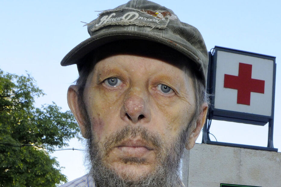 DOENTE, ONCOLÓGICO, AGRAFOS, HOSPITAL, FARO