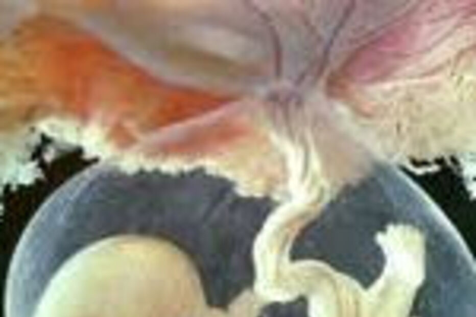 Placentas,Sáude,Medicina,China