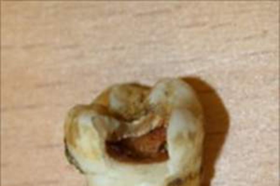 dente, dentista, john lennon, leilão, reino unido