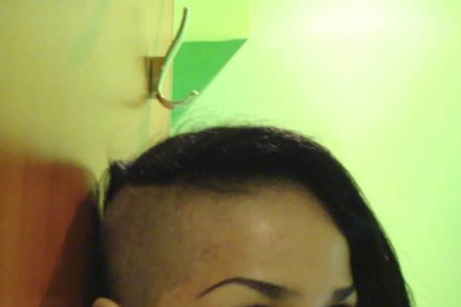 lábios, botox, rússia, cirurgia, jessica rabbit, são petersburgo