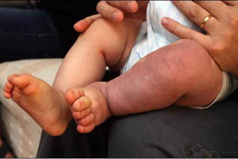 taxa de mortalidade infantil, nados-vivos, Portugal