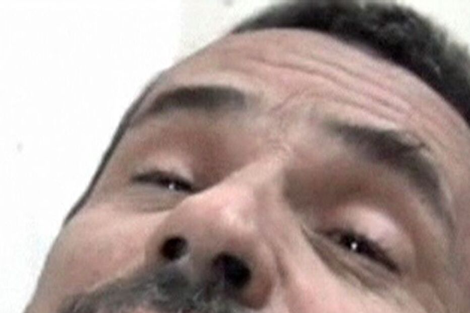 REPÓRTER, SÍRIA, FERIDO