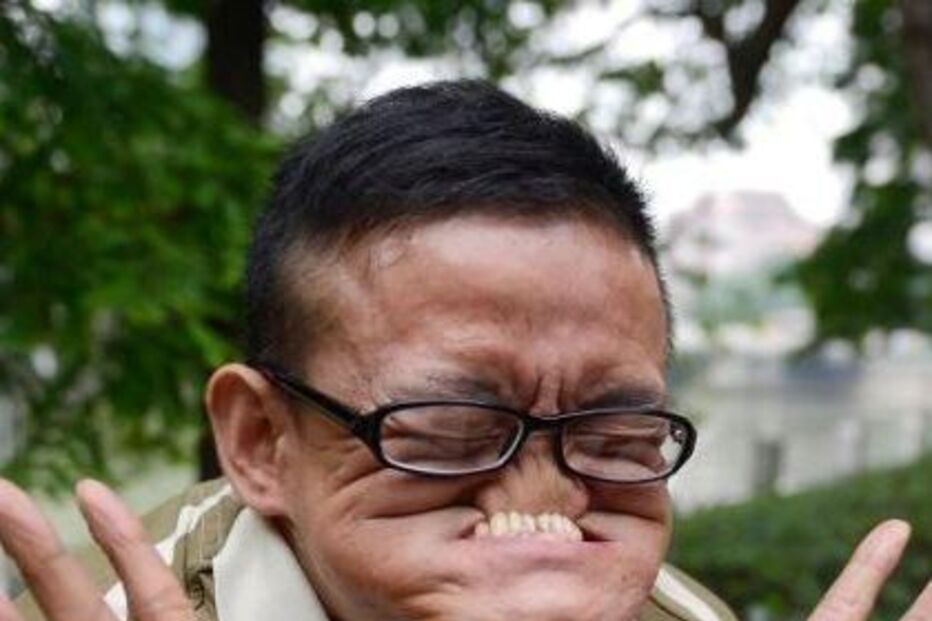 Ele tem a cara mais feia do Mundo  