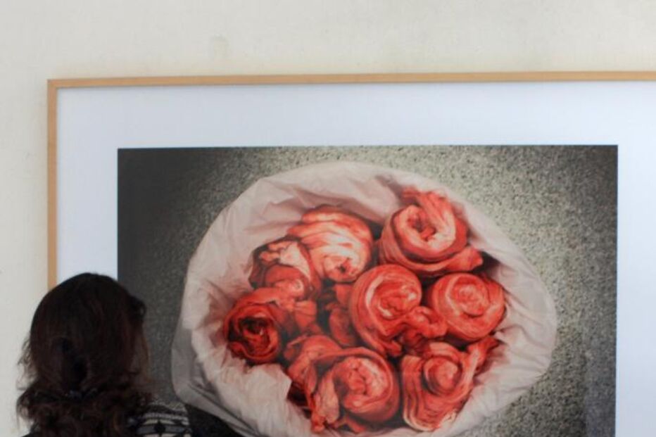 exposição, hospital, fotografia, fotojornalismo, lisboa, miguel bombarda