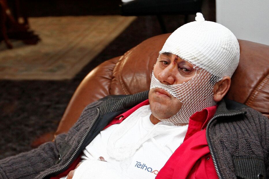 LOURINHÃ, HOMEM, GANG, ATAQUE, PAU, LADRÕES, ROUBO