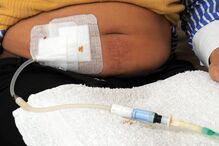 INSUFICIÊNCIA RENAL, SAÚDE, DIÁLISE