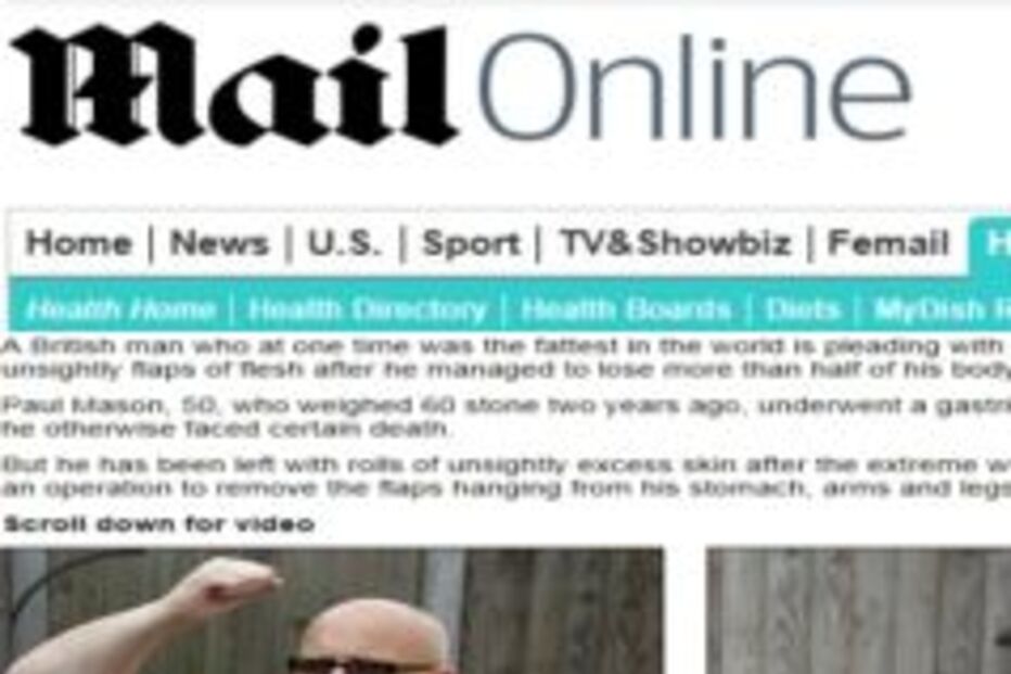 Reino Unido, Paul Mason, homem mais gordo do mundo, sistema nacional de saúde, perdeu 295 quilos