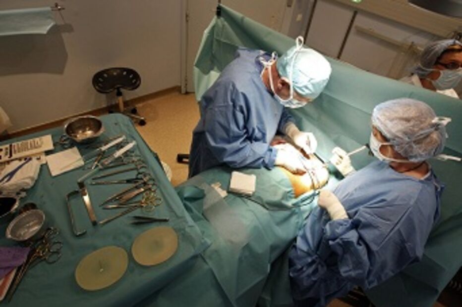 rutura, saúde, implantes, cirurgia