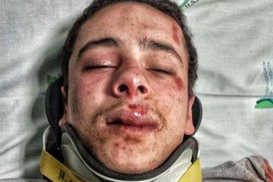 râguebi, pancada, Cascais, jogo, Cascais, Direito, PSP, Francisco Carrelhas da Fonseca, estudante, traumatismo craniano