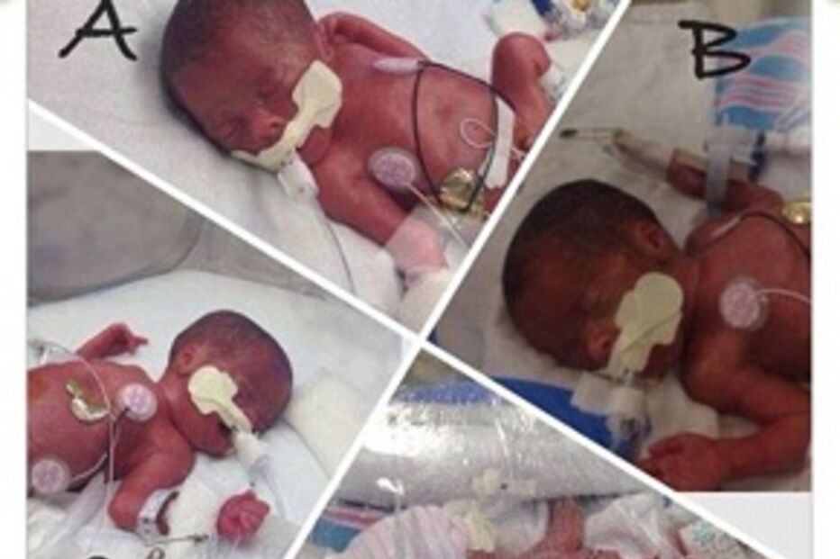 Insolito, Gemeos, trigemeos, quadrigemeos