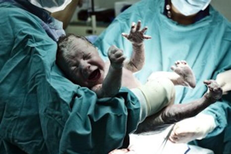 casal, brasil, gémeas, inseminação, artificial