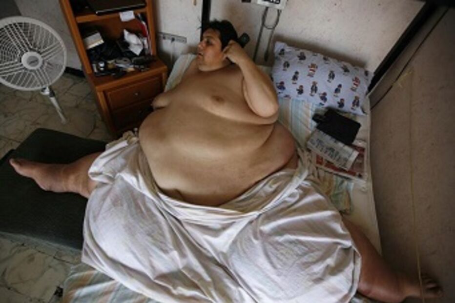 México, morreu, homem, obeso, mundo, Manuel Uribe Garza, complicações, renais