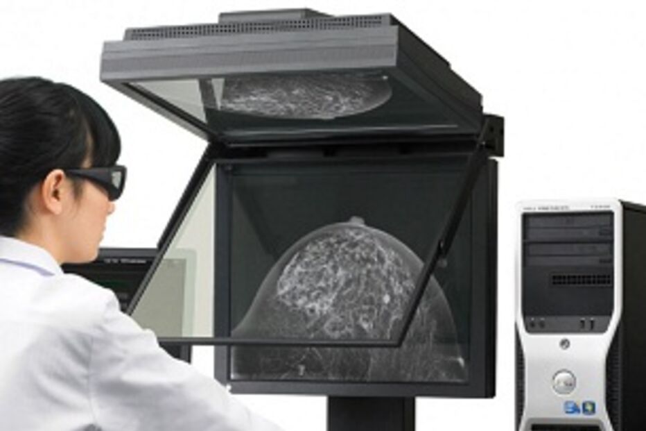 mamografia, saúde, doença, paciente, equipamento, fujifilm, imagem, 3d, digital