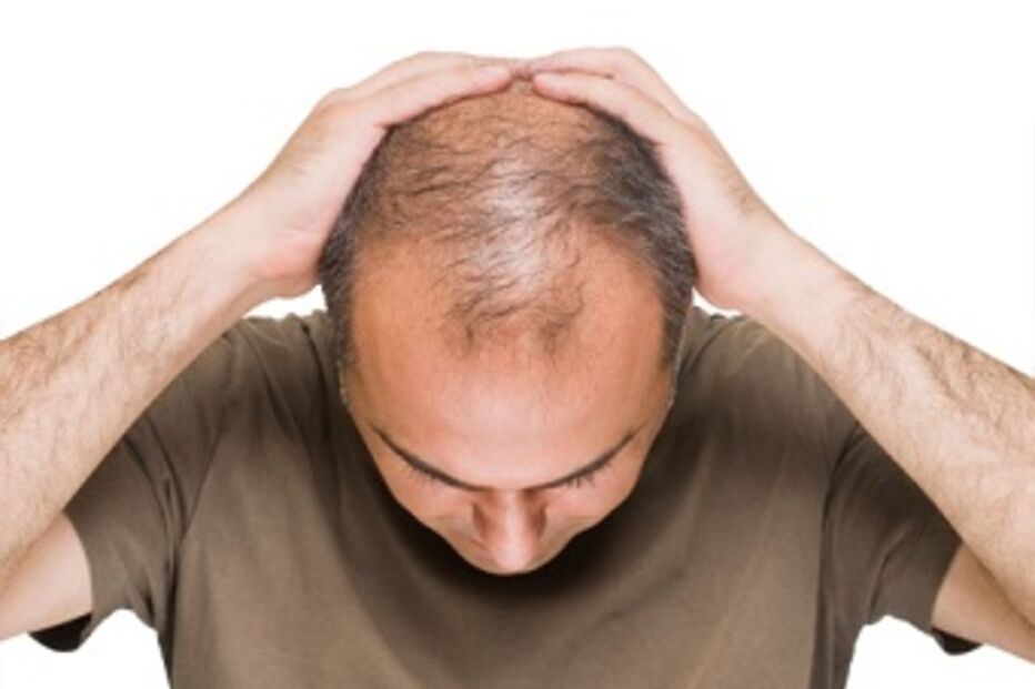 tratamento capilar, medicamento, regeneração, ruxolitinib, mielofibrose, doença, células, sangue, estudo, cabelo, Universidade da Colômbia, EUA, Nature Medicine