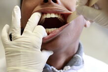 dentes, implantes, dentistas