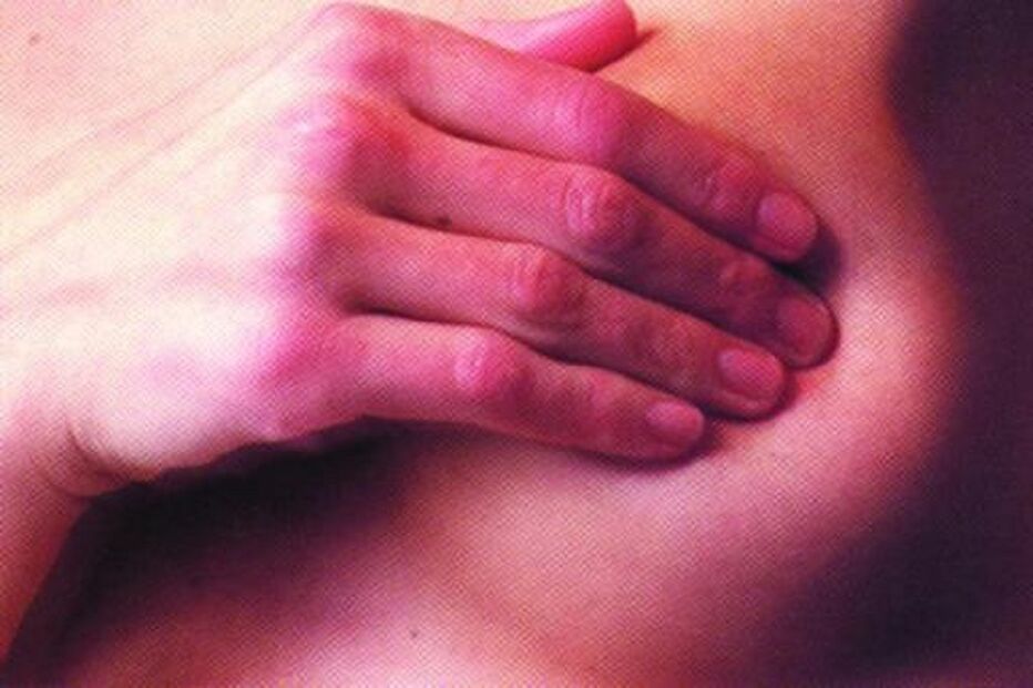 cancro, mama